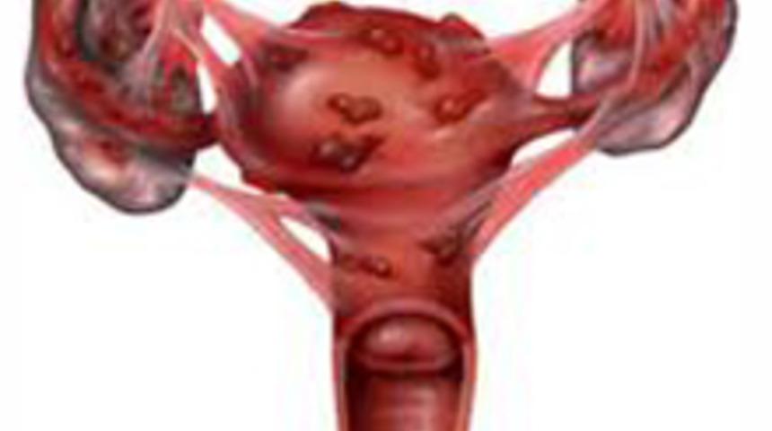 &Ccedil;ikolata Kisti