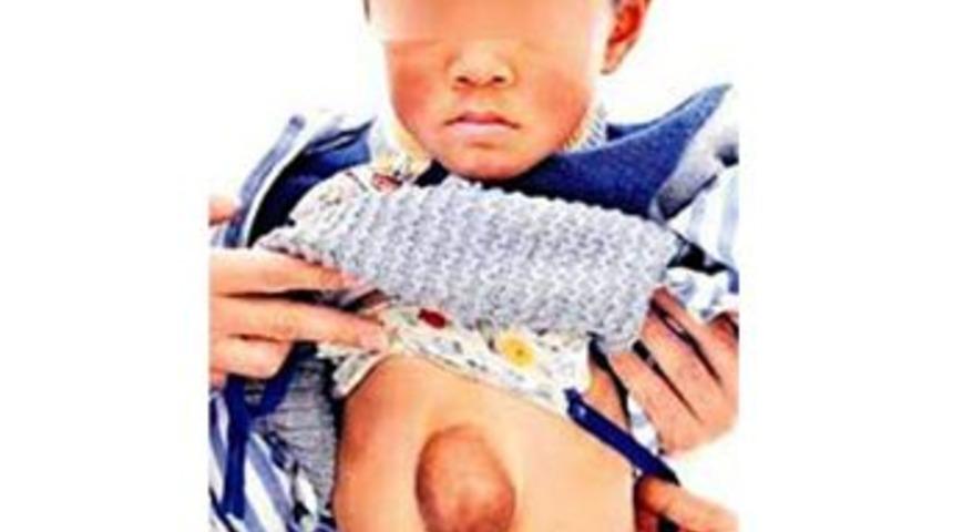 Kalbi g&ouml;beğinde