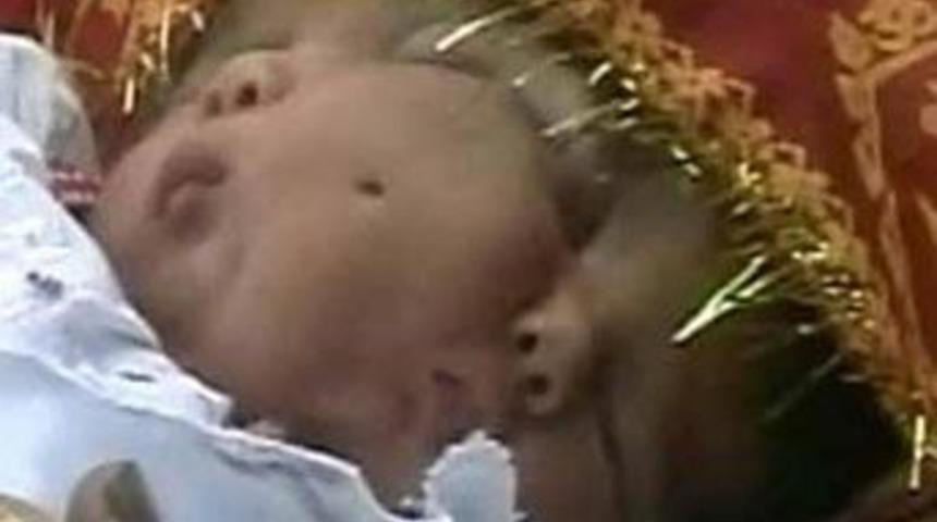 İki y&uuml;zl&uuml; bebek