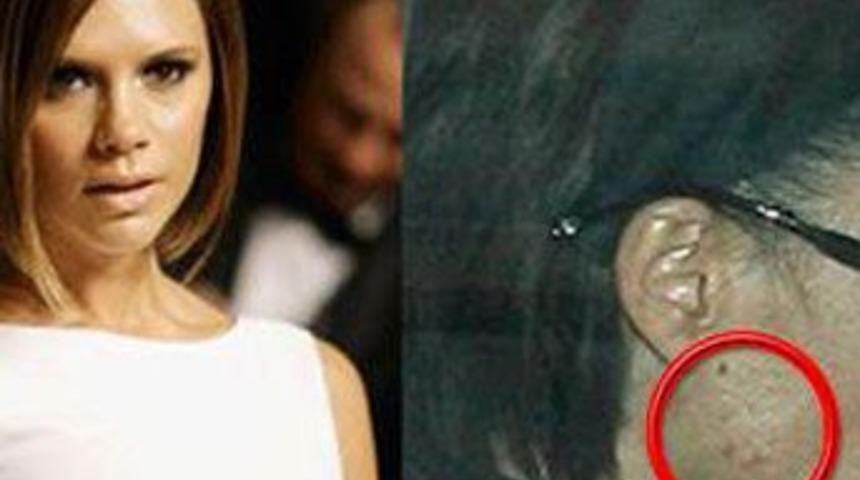 Vici hastalanmaya başladı!