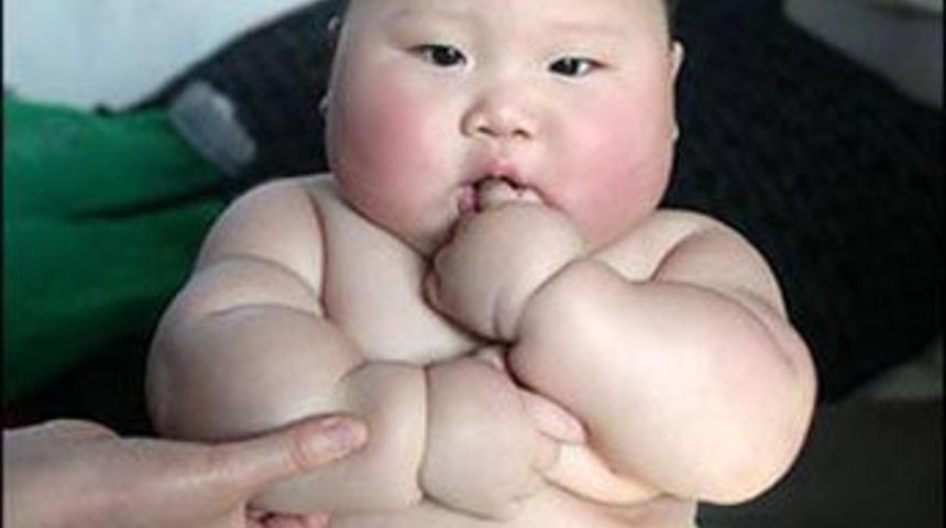 &Ccedil;ocuklarda obezite 5 yaşa kadar oluşuyor