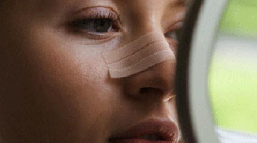 Burun estetiğinde yeni ufuklar