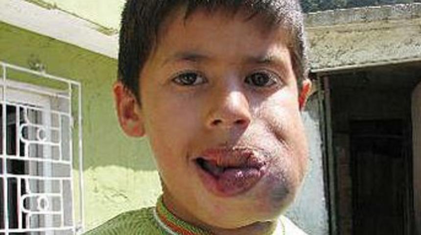 Damarları dudaklarında toplanıyor