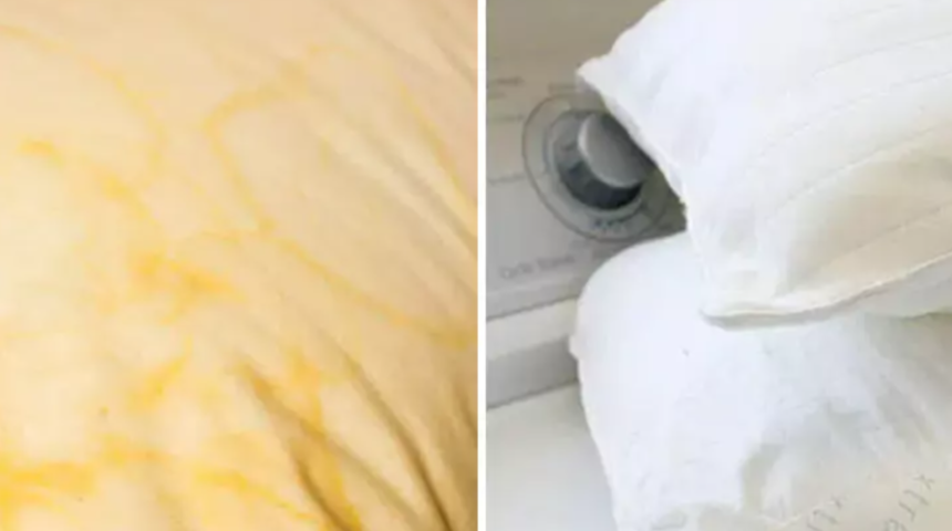Sararmış yastık lekelerini anında &ccedil;ıkarıyor! Tek malzeme ile kar gibi beyaz oluyor