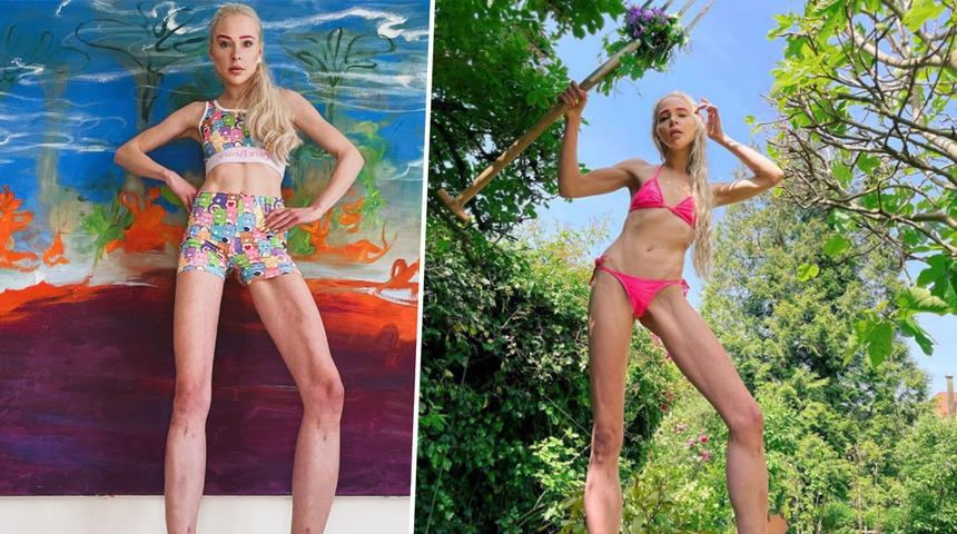 Boyunu 15 cm uzatmak için ameliyat oldu! Operasyonun fiyatı dudak uçuklattı... “Çok pişmanım”