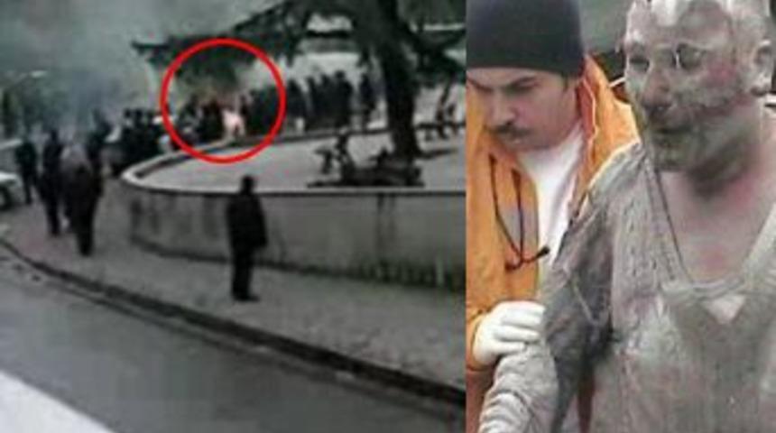 Acılı baba kendini b&ouml;yle yaktı!