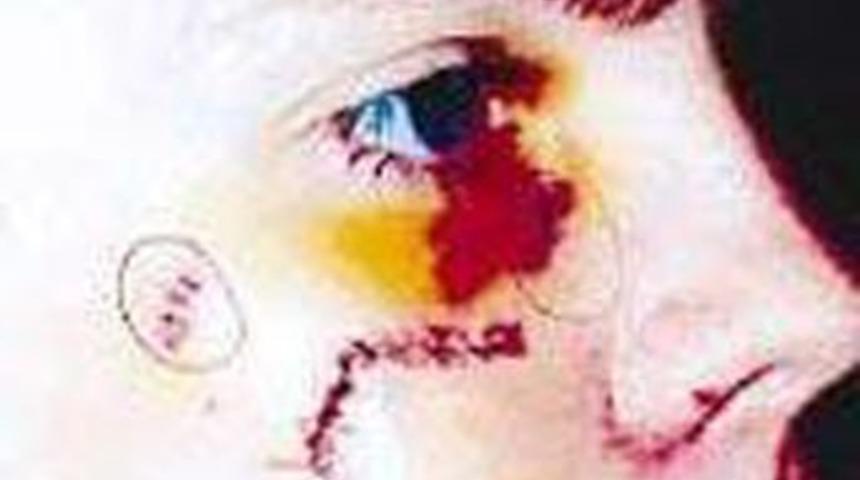 Y&uuml;z par&ccedil;alayan modele 2.5 yıl