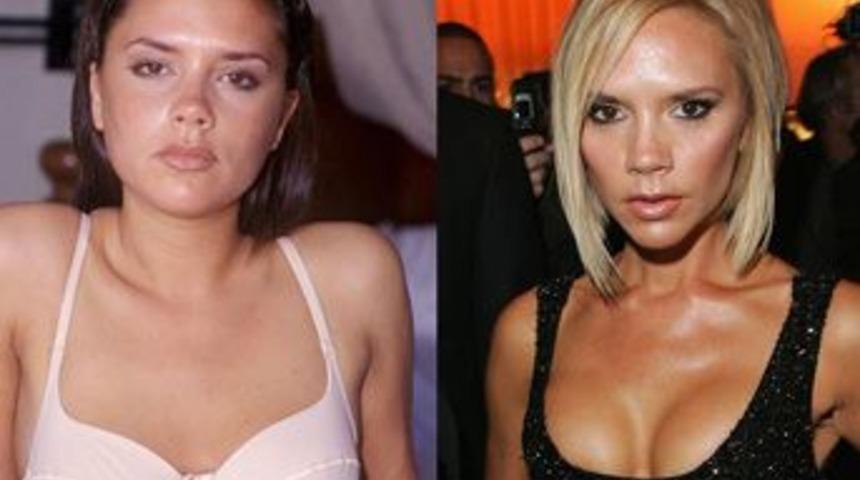 Estetik yaptırmasaydılar beğenir miydiniz?