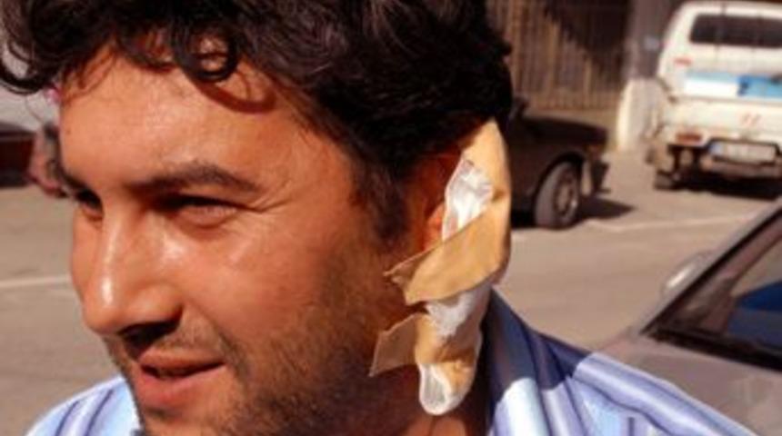 &Ccedil;ay i&ccedil;erken kulağından vuruldu