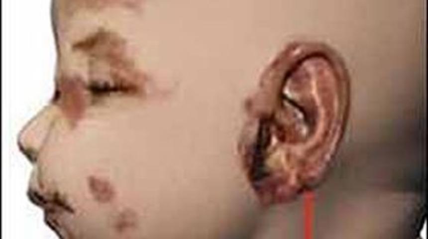 "Bebek P" i&ccedil;in 6 ay &ouml;nce uyarı yapılmış