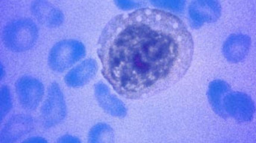 Zonguldak'ta &ouml;l&uuml;mc&uuml;l vir&uuml;s paniği