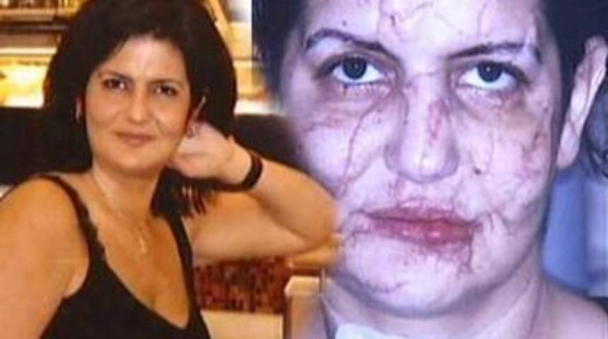 Almanya yeni y&uuml;z&uuml;ne kavuşan kadını konuşuyor