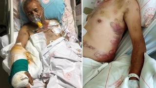 Eski muhtar dehşeti: Abisini sokak ortasında av tüfeğiyle vurdu! Vücuduna 300'e yakın saçma isabet etti