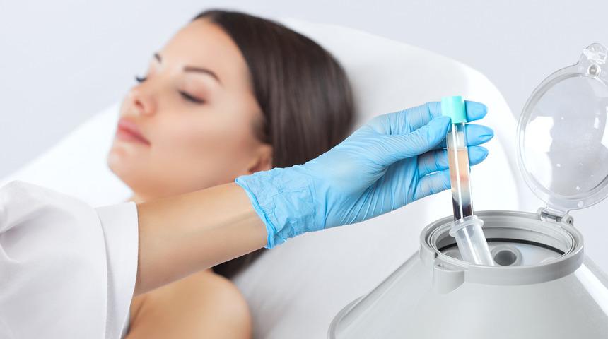 PRP tedavisi nedir? PRP tedavisi ne işe yarar?