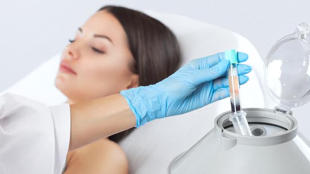 PRP tedavisi nedir? PRP tedavisi ne işe yarar?