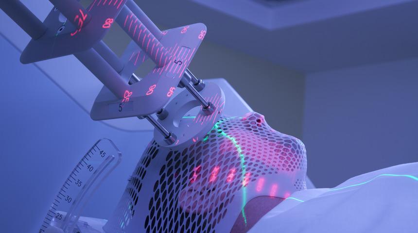 Işın tedavisi kanseri yok eder mi? Akciğer kanserinde ışın tedavisi ne kadar sürer?