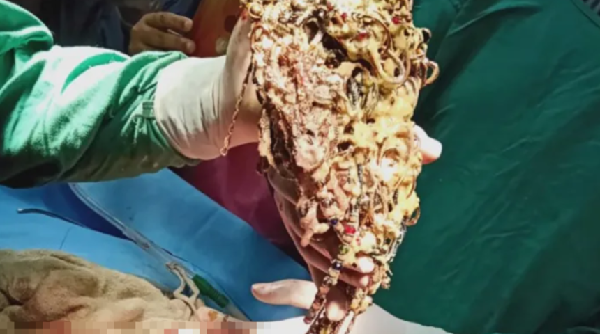 Doktorları bile şaşkına çevirdi! Midesinden mücevher ve madeni para çıktı... Değeri dudak uçuklattı