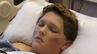 Pitbull sürüsünün hedefi oldu! 10’u birden saldırdı... “Resmen oğlumu yiyorlardı”