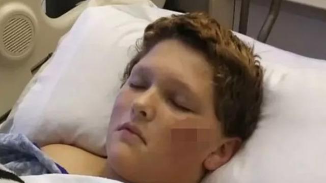 Pitbull sürüsünün hedefi oldu! 10’u birden saldırdı... “Resmen oğlumu yiyorlardı”