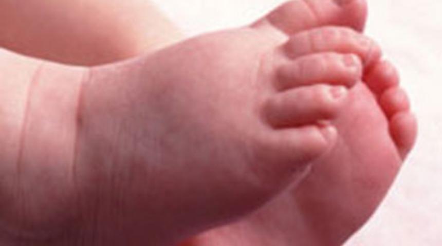 Erken doğan bebekler neden &ouml;l&uuml;yor?