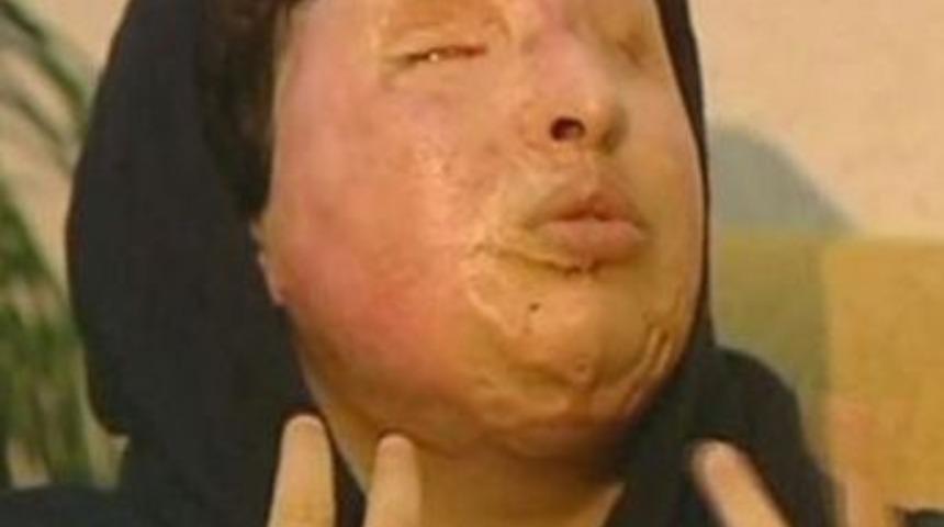 Asitle k&ouml;r edene kısasa kısas