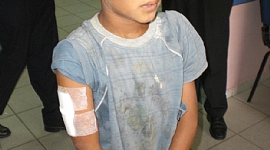 Kavganın ortasında kalan &ccedil;ocuğu pitbull ısırdı