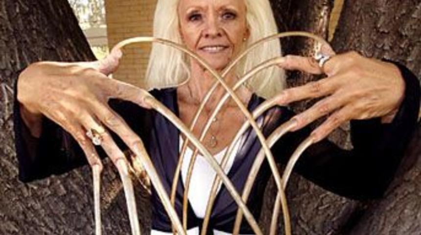 D&uuml;nya rekoruna sahip tırnaklar kazada kırıldı