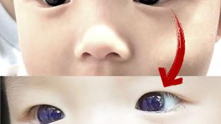 Akılalmaz olay! Gözleri kahverengiydi, parlak maviye döndü... Bilim insanları şaşkına döndü!