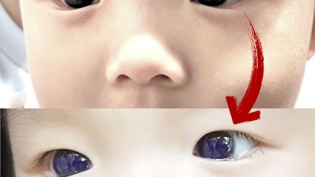 Akılalmaz olay! Gözleri kahverengiydi, parlak maviye döndü... Bilim insanları şaşkına döndü!