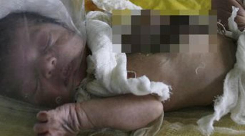 Kalbi dışarda doğdu