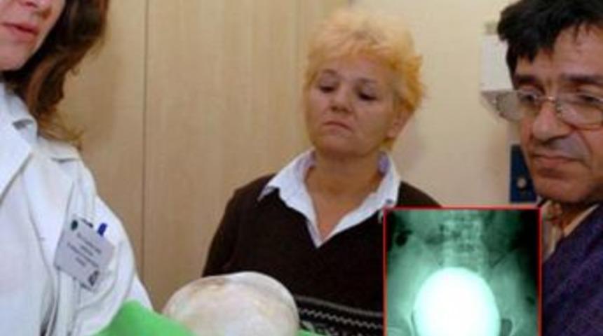 Doktorlar bile inanamadı!