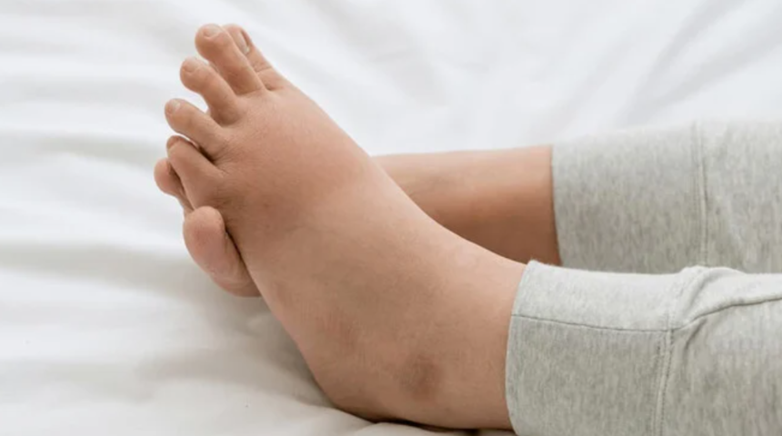 Bu belirtileri yaşıyorsanız vakit kaybetmeden doktora gidin! Böbreklerinizde sorun olabilir