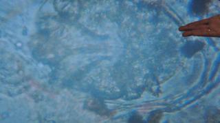 İnsan vücuduna girdiği an yayılıp evini inşa ediyor! Pandemi sonucu yüzde 50 arttı