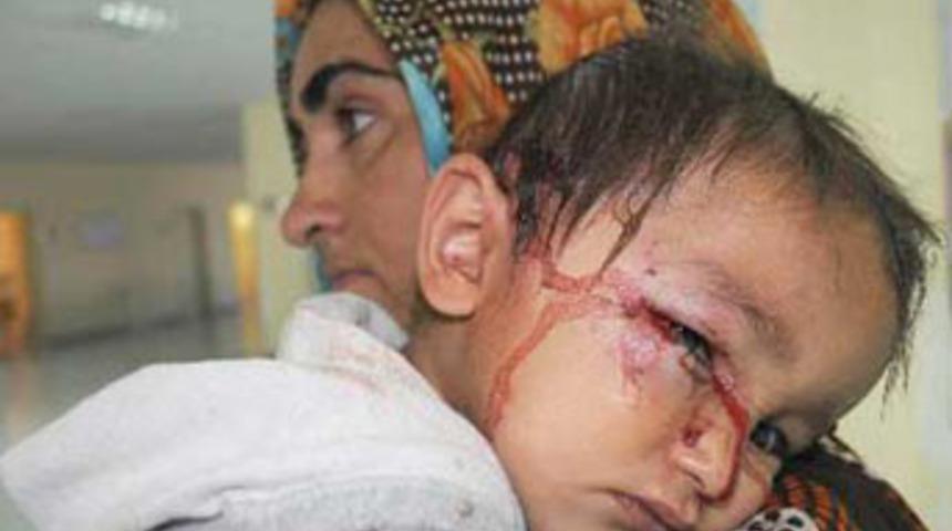 Amcasının k&ouml;peği kafasını par&ccedil;aladı