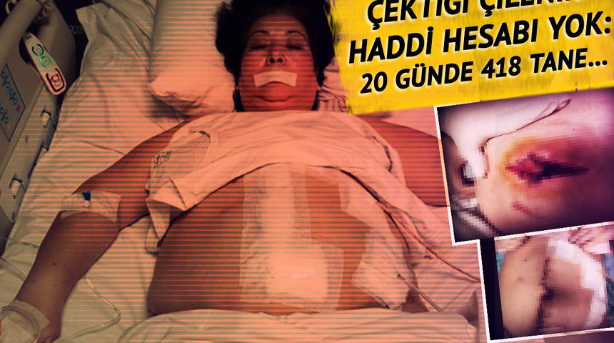 Hastane hastane dolaştı, 20 günde 418 dikiş yedi! Sabıkalı doktor bu kez Güneri'nin başını yaktı: 'Resmen hayatımı elimden aldı' 