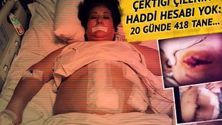 Hastane hastane dolaştı, 20 günde 418 dikiş yedi! Sabıkalı doktor bu kez Güneri'nin başını yaktı: 'Resmen hayatımı elimden aldı' 