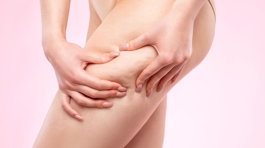 Selülit nasıl geçer, ne iyi gelir? Evde uygulanabilecek yöntemlerle selülit nasıl yok edilir?