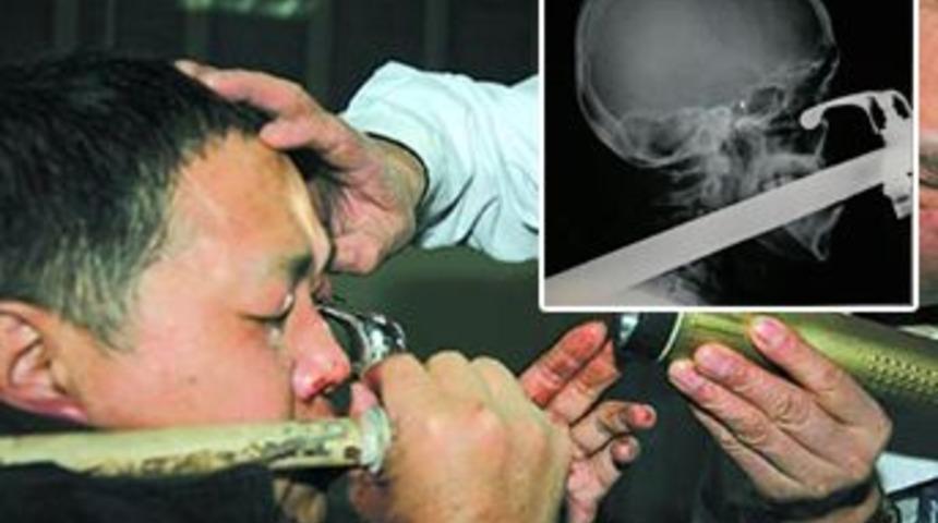 G&ouml;z&uuml;ne musluk giren adam