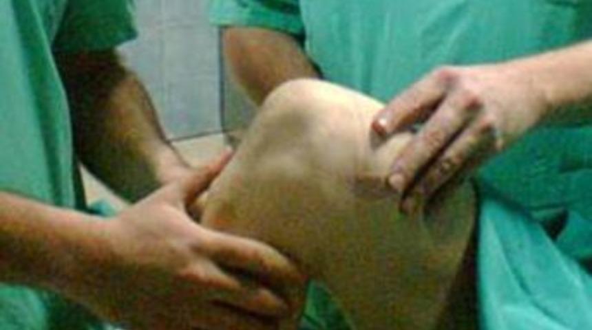 Menisk&uuml;s yırtığı m&uuml;dahale gerekmiyor