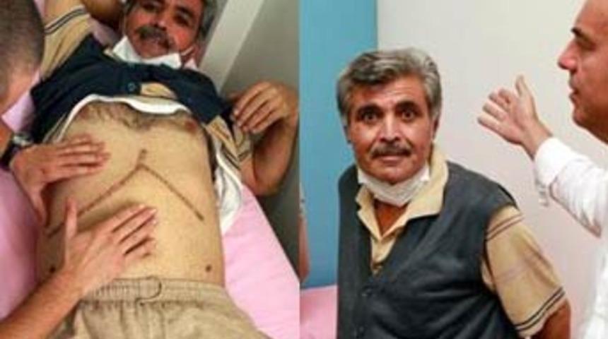 D&uuml;nyada bilinen beşinci vaka