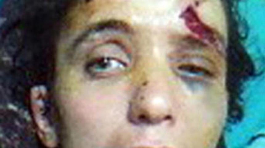 Eşinin kulağını kesen koca serbest!