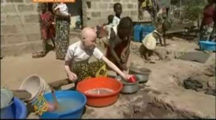 Albinoyu &ouml;ld&uuml;r&uuml;p bacağını kestiler