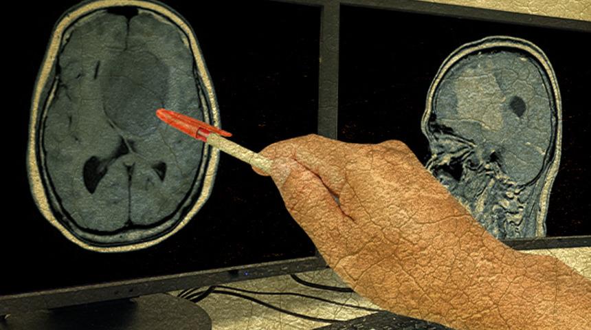 Uzun yıllardır konuşamayan felçli kadın, tekrar 'konuşabilir' oldu... Hem de sadece düşünerek!