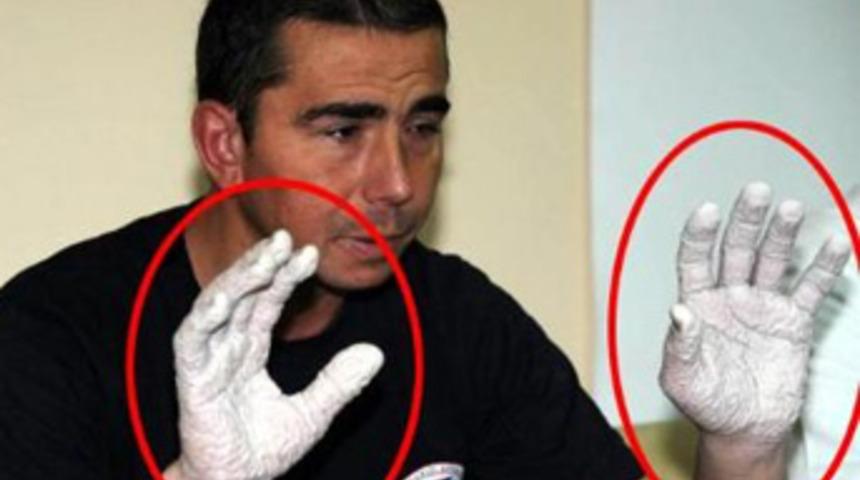 D&uuml;nya rekortmeni olmanın bedeli