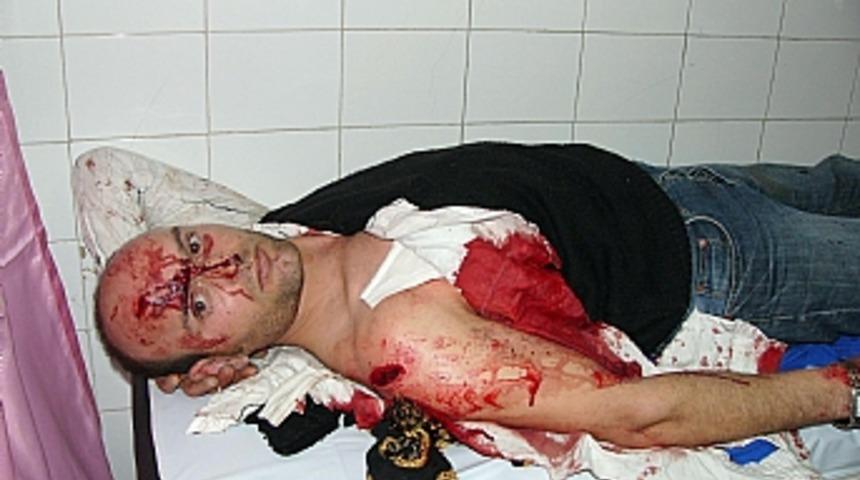 Samsun'da baltalı dehşet: 3 yaralı