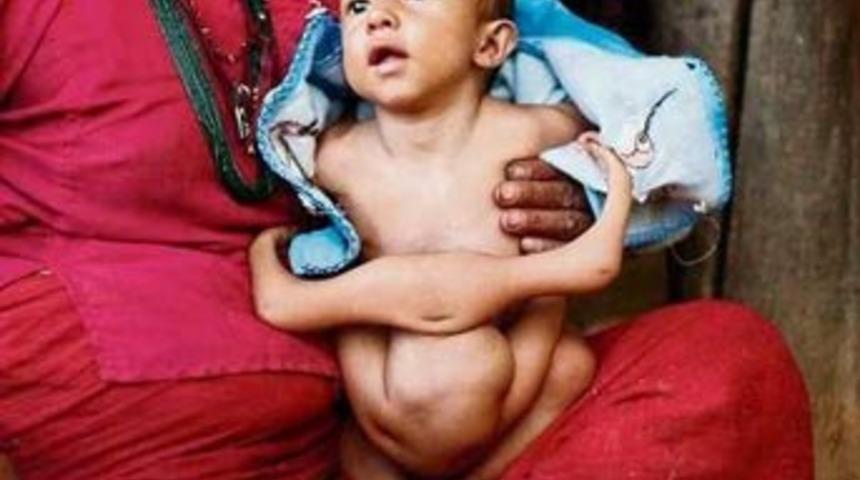 Annesi 5 g&uuml;nde ancak doğurdu