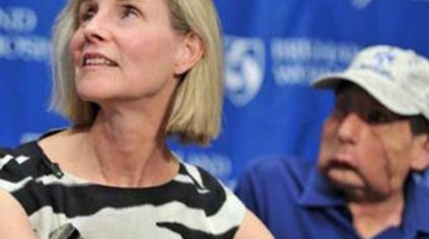 Eşinin y&uuml;z&uuml;yle arkadaş oldu