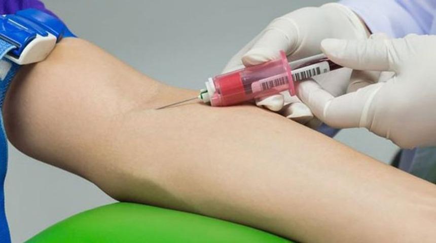 Bu belirtiler varsa dikkat! Milyonlarca insanın hayatına mal oluyor, saniyeler hayat kurtarıyor