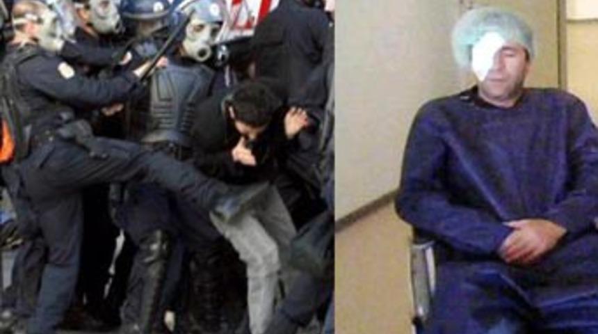 Polis copu, &ouml;ğretmeni k&ouml;r etti