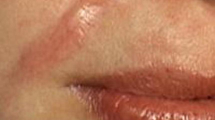 Y&uuml;z&uuml;n&uuml; kesen adamla evlenecek